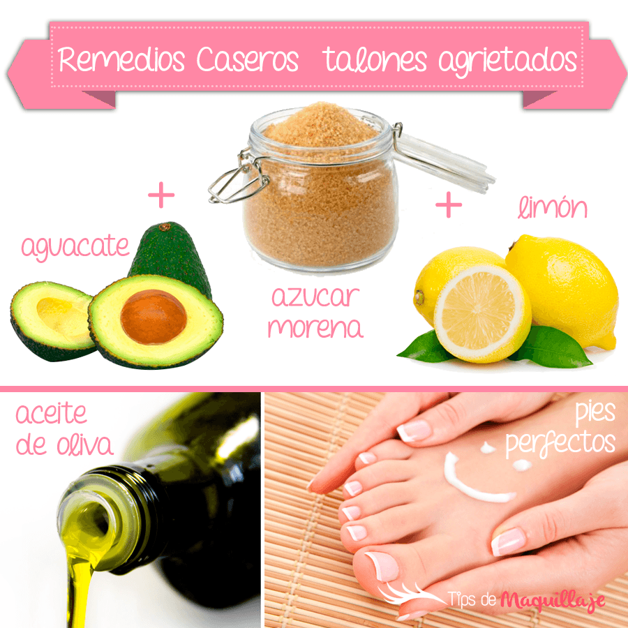 Remedios caseros para talones agrietados
